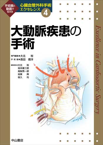 大動脈疾患の手術