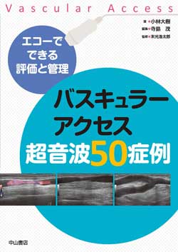 エコーでできる評価と管理　バスキュラーアクセス超音波50症例