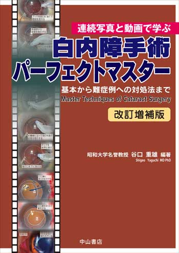 白内障手術パーフェクトマスター　改訂増補版