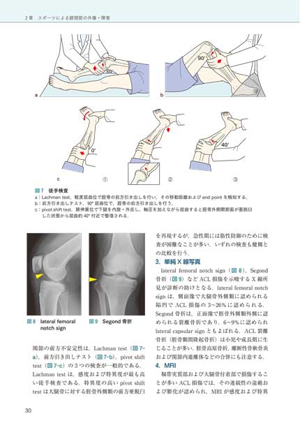 講座 スポーツ整形外科学 | 株式会社中山書店 講座 スポーツ整形外科学 | 株式会社中山書店